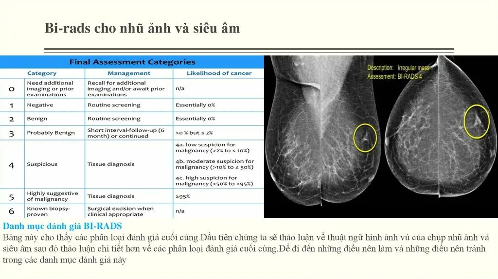 Bi md. Маммография birads 4. Маммография классификация bi-rads. Маммография молочных желез ACR 3 birads 1. Маммография молочных желез ACR Тип 3 birads 2.