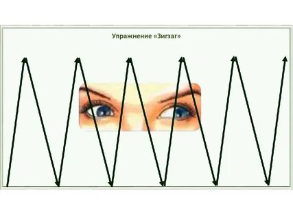 Зигзаги в глазах