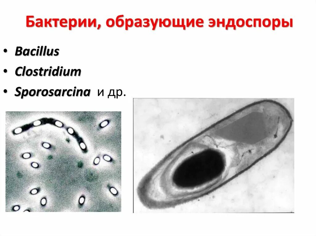 Микроорганизмы образующие споры. Эндоспоры образуют клостридии. Строение эндоспоры бактерий. Бациллы с эндоспорами. Эндоспоры образуют бактерии.