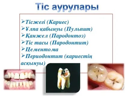 Модельдермен жыныстық қатынас