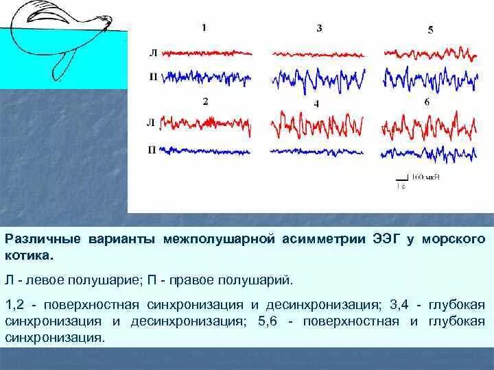 Ээг асимметрия. Асимметрия на ээг. межполушарная асимметрия на ээг. синхронизация и десинхронизация ритмов ээг. синхронизация ритма ээг.