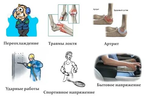 Травма локтевого сустава