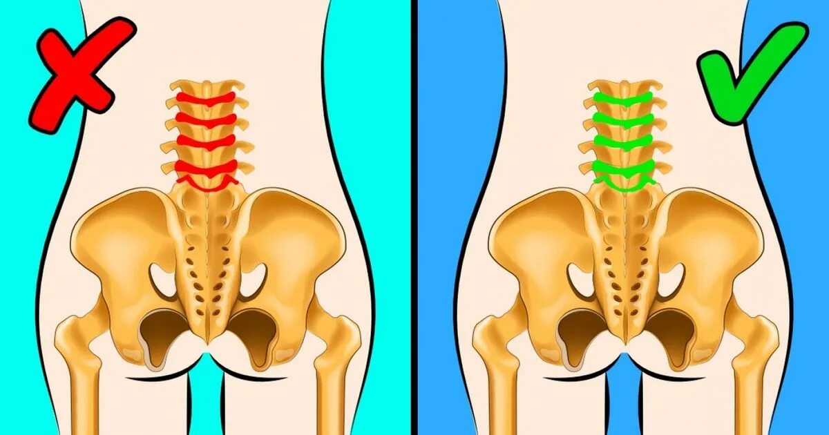 Как облегчить пояснице. Вправить позвонки.