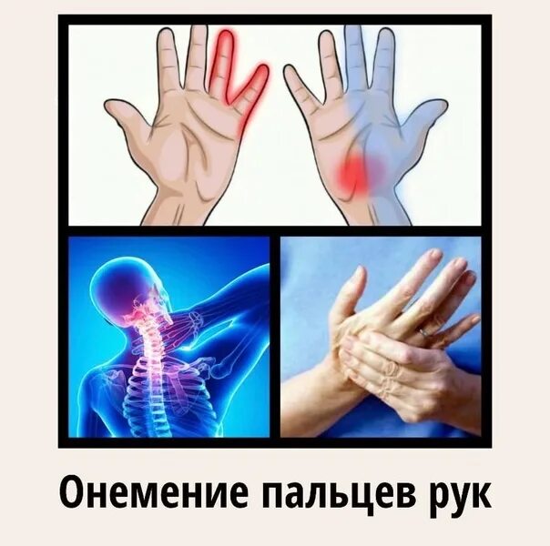 От чего происходит онемение рук. Онемение одной половины тела.