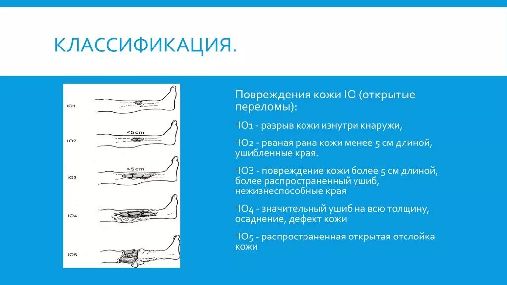 Степени открытого перелома. Классификация повреждений кожи. Повреждения кожи таблица. Классификация травм. Классификация ранений.