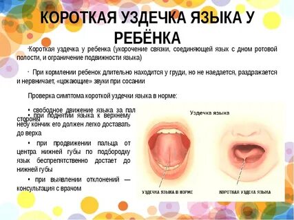 Дефекты языка у детей