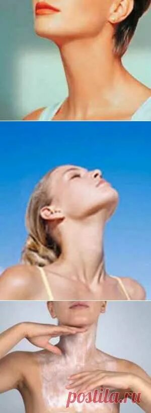 Swollen neck glands may indicate cancer