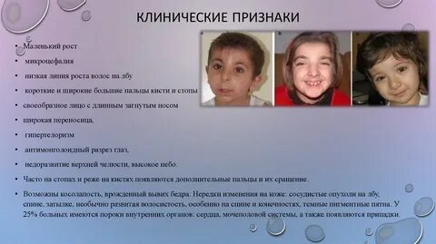 Олигофрения признаки