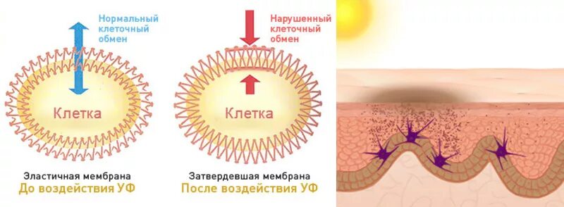 Воздействие УФ излучения на кожу. Влияние УФ лучей на кожу. Воздействие УФ лучей на кожу. Воздействие ультрафиолета на кожу. Радиация кожи