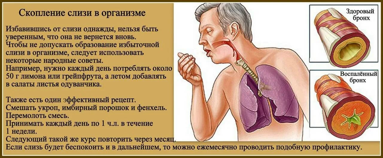 Почему у ребенка мокрота