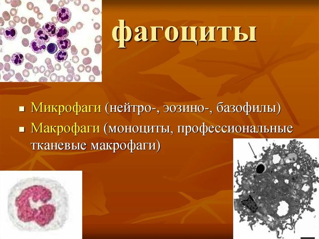 Тканевые макрофаги. Тканевые фагоциты. Базофилы это макрофаги. Виды фагоцитов. Свободные макрофаги