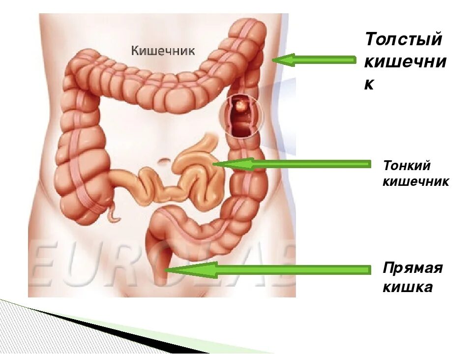 Сигмовидный отдел толстой. Строение Толстого кишечника и тонкого кишечника. Тонкая и толстая кишка строение. Отделы тонкого и Толстого кишечника человека. Прямая толстая и тонкая кишка.