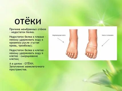 Отекают ноги какие анализы сдать