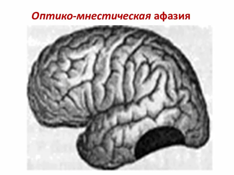 Проблема афазий