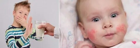 Бывает ли у детей аллергия