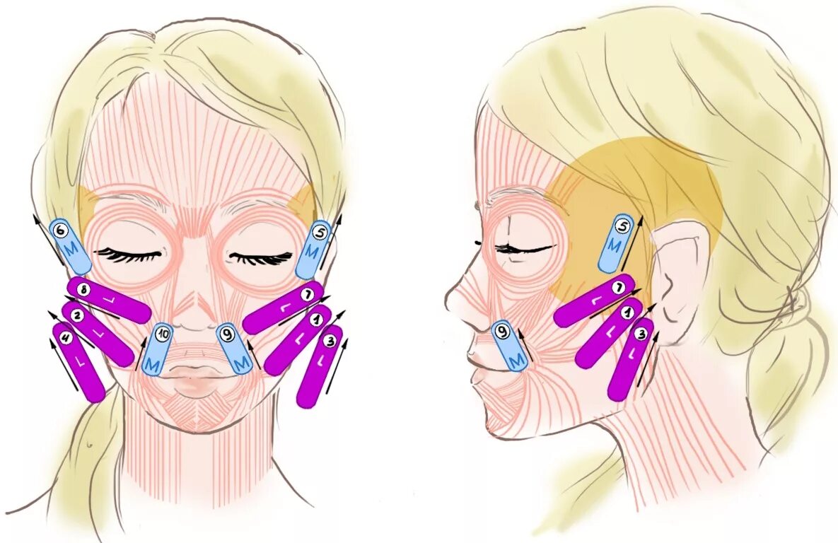 Как пользоваться подтяжками для лица. Тейпирование кисетных морщин. Схема тейпирования лица от морщин. Тейпирование морщин марионеток схема. Тейпирование лица схемы.
