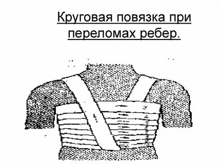 Повязка на ребра