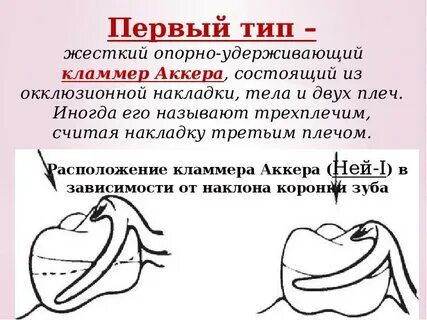 Классификация системы нея