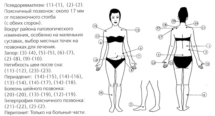 Точки акупунктуры при отеках ног. Биологически активные точки на спине. Точек который можно использовать и. Бальзам звездочка точки от кашля. Экстрактор comedone.