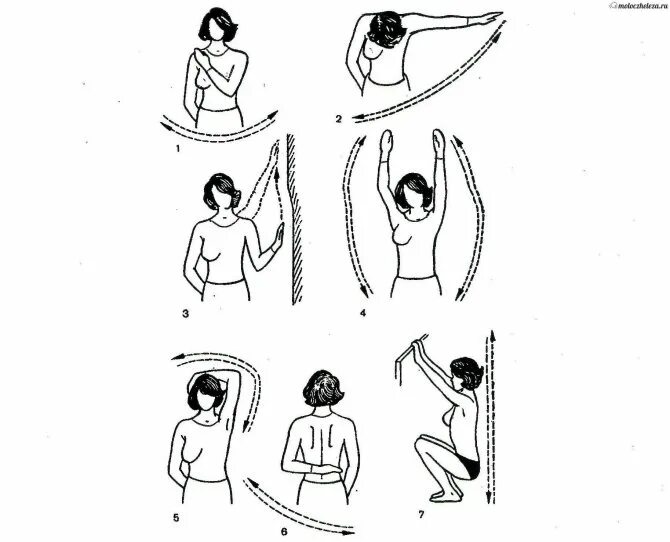 После операции молочной железы и лимфоузлов. Лечебная физкультура после мастэктомии. Лечебная гимнастика после мастэктомии молочной железы. Физкультура после мастэктомии комплекс упражнений. Упражнения против лимфостаза руки после мастэктомии.
