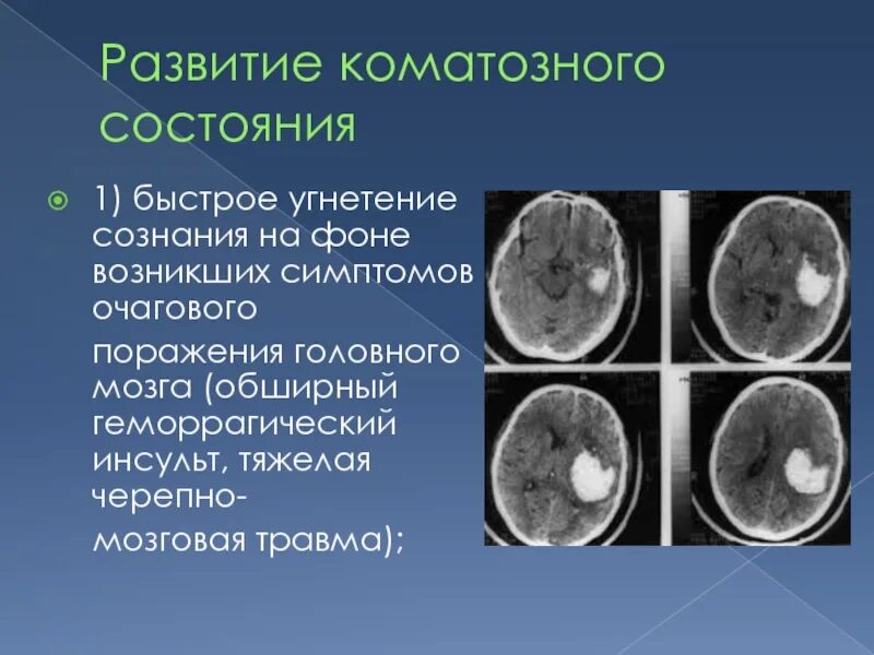 Токсическое поражение головного мозга кт. Очаговое поражение мозга. Очаговые поражения головного мозга. Очаговые поражения головного мозга ЧМТ. Диффузное поражение головного