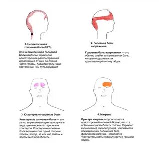 Головная боль в разных частях головы