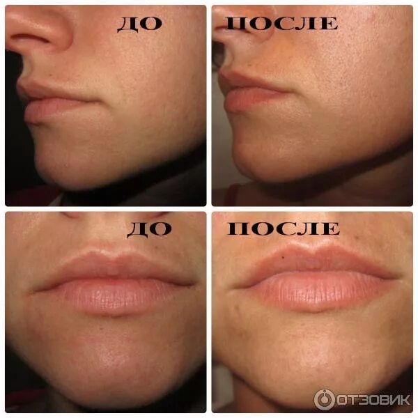 Отзыв о Микроблейдинг губ Ещё одна болезненная процедура для "естественного" мак