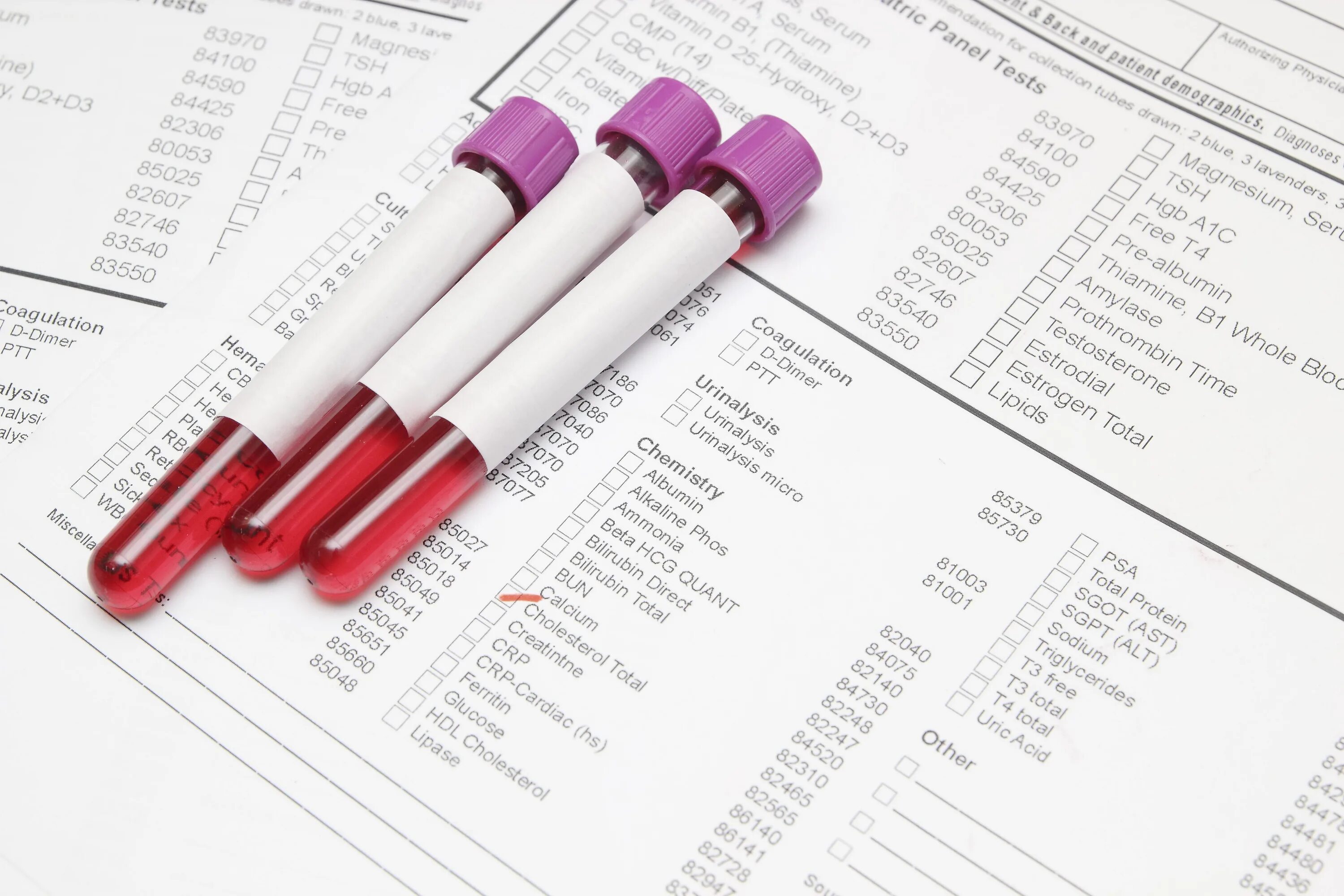 How good test. Test analysis. general blood test. соэ метр. test paper.