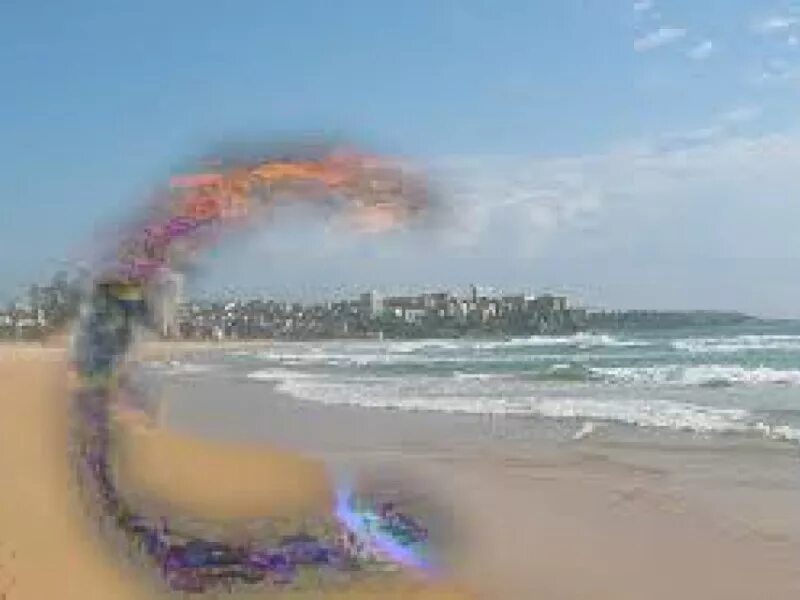 Деструкция стекловидного тела. Клинические проявления глаукомы. Мигрень со зрительной аурой. Фотопсия вспышки перед глазами. Мерцательная скотома аура мигрени.