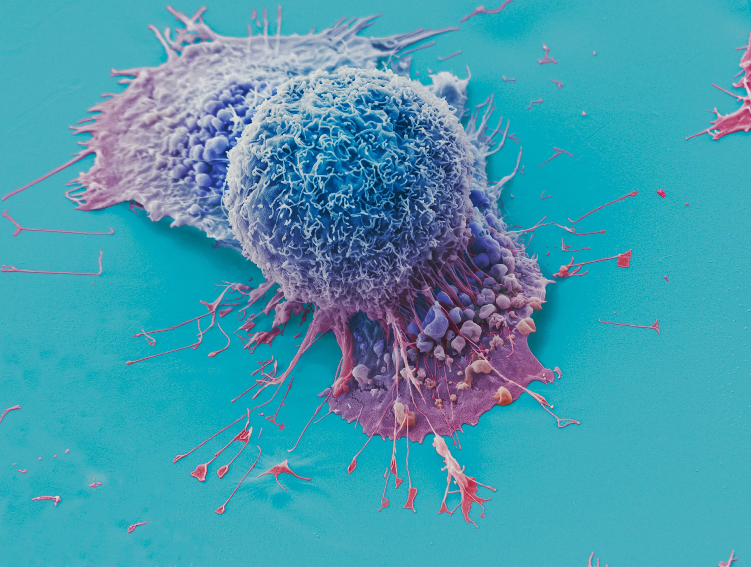 Культура раковых клеток. Раковые клетки под микроскопом. Питание раковой клетки