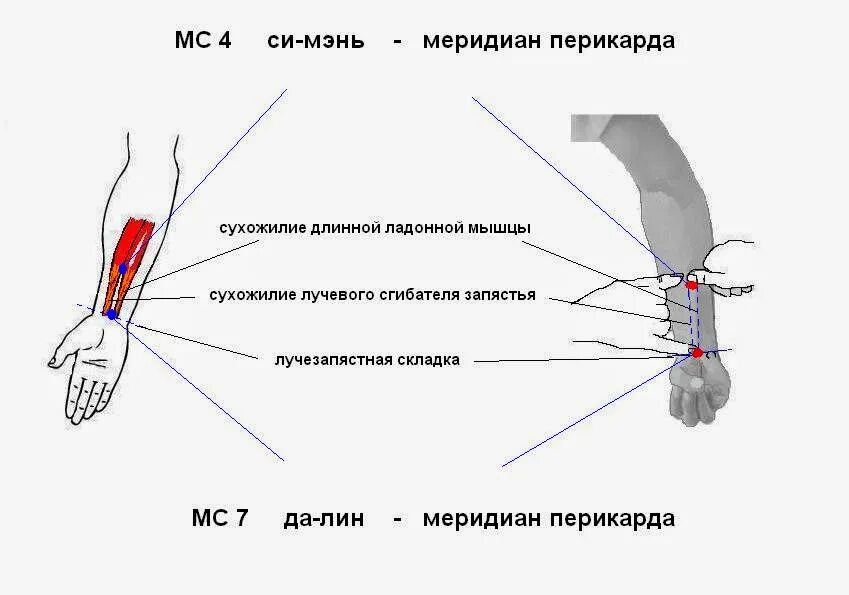 Точка си. Точка mc4 си-Мэнь. Точка Инь си. Сухожильно мышечный Меридиан перикарда. Кис точка