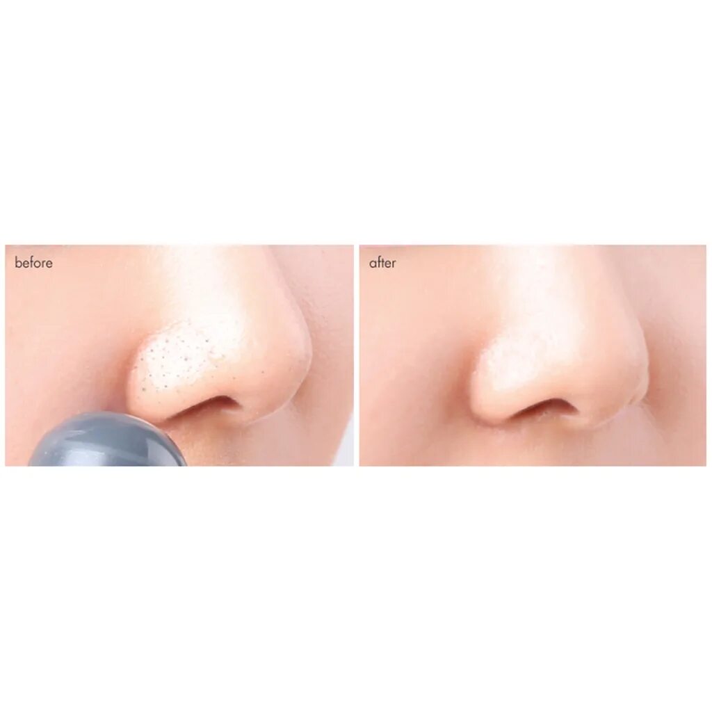 Blackhead pore cream. Tony moly скраб для лица tako pore blackhead scrub stick. manyo blackhead &amp; pore cream. тони моли тако пор блэк. manyo factory blackhead and pore cream 30ml.