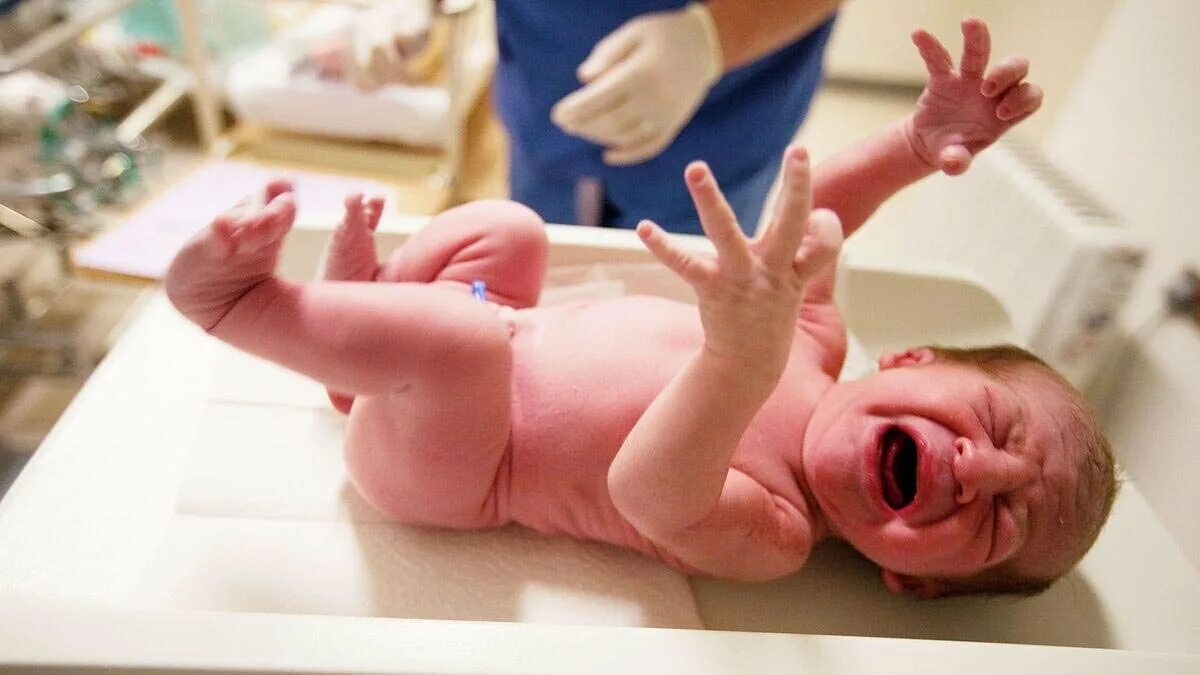 Пук новорожденных. Новорожденный ребенок только родился.