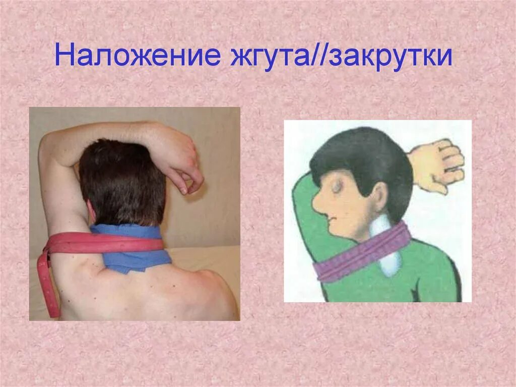 Как вставить жгут. Как вставить жгут