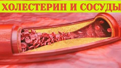 Препарат стенки сосудов