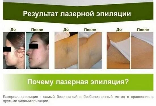 С какого возраста можно делать лазерную