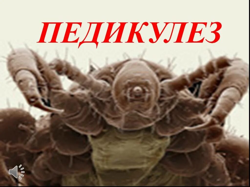 Реклама вшей