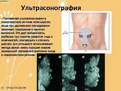 Поверхностный режим