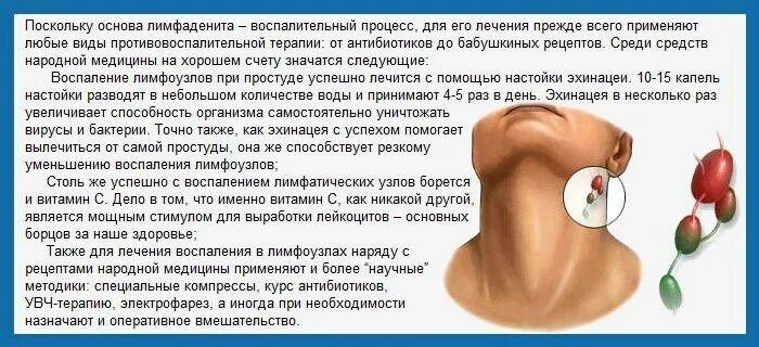 Хронический лимфаденит мкб