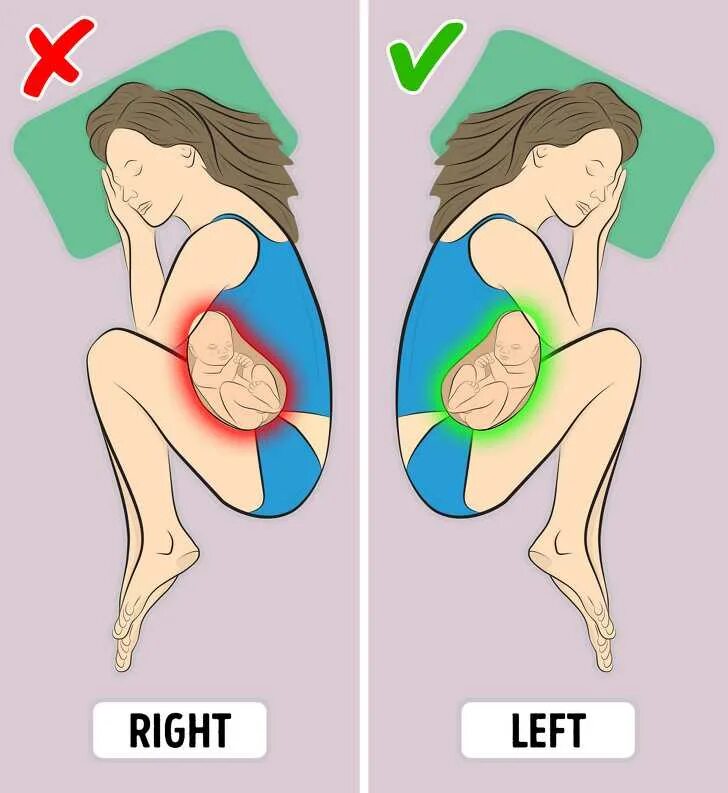 Удобные позы для беременных. Позы сна для беременных. Позы сна для беременных 3 триместр. Удобная поза для сна беременным. Почему беременным нельзя сидеть