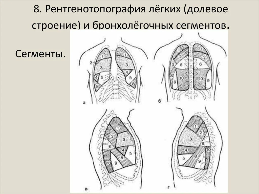 Строение легких доли. Долевое и сегментарное строение лёгких. Долевое строение легких. Сегментарное строение легких в прямой проекции. Долевое строение легких.