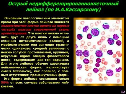 Клеточный лейкоз
