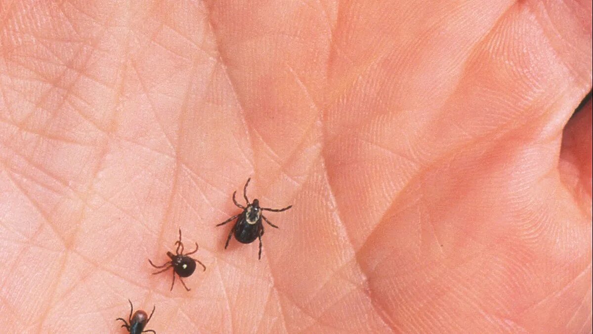 Tick bite make you allergic to. Tick bite make you allergic to