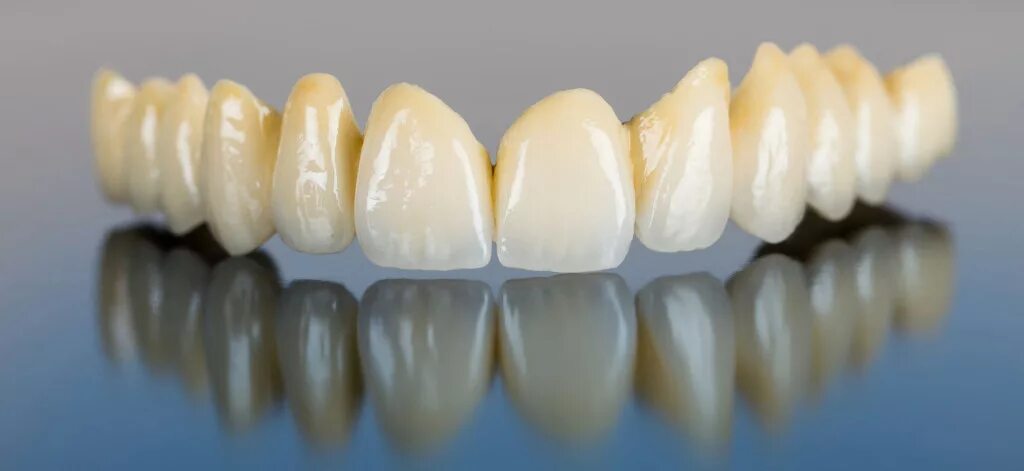 зубы из диоксид циркония. мост из циркония на передние зубы. металлокерамические коронки на передние зубы. диоксид циркония. стоматология коронка диоксид циркония.