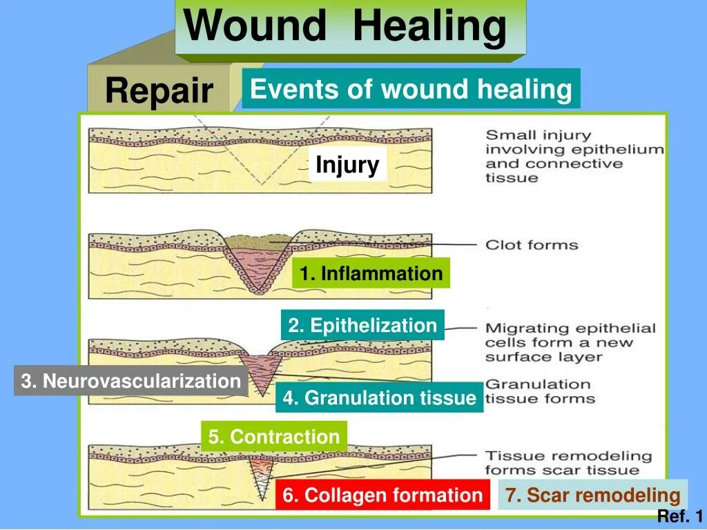 What is a wound. What is a wound
