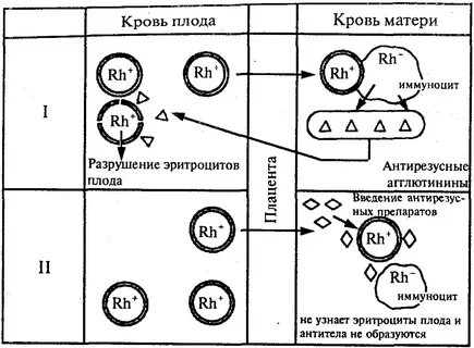 Резус конфликт плода