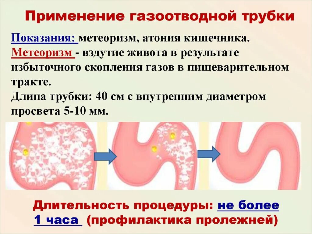 Удаление воздуха из желудка. Скапливается воздух в кишечнике. Упражнение для выхода кишечных газов. Схема образования газов в кишечнике. Скопление газов в кишечнике.