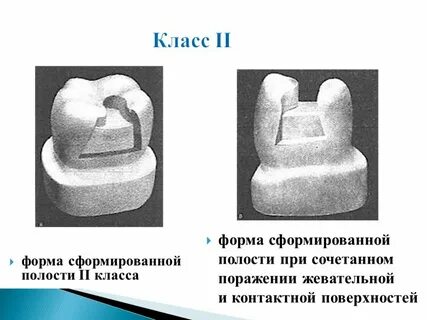 Дополнительная полость