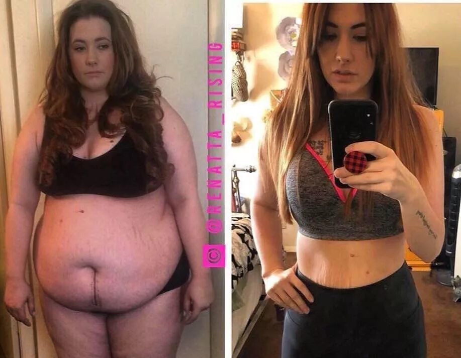 Стала толще. Девушки которые потолстели. Жирные девушки до и после. Девушка потолстела до и после.