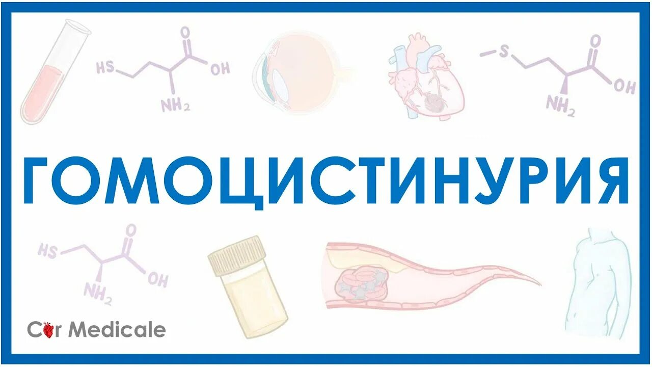 Гомоцистинурия клинические проявления. Гомоцистинурия дефектный фермент. Гомоцистинурия генетика. Лечение ковида в 2024 году